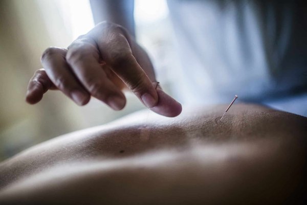 Annuaire acupuncteur à Nantes : prenez facilement un rendez-vous